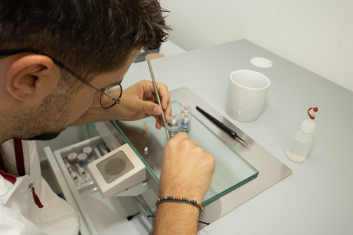 Rifinitura a mano di un dispositivo dentale